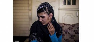 Συγκλονίζει η ιστορία 17χρονης Πακιστανής που επέζησε από 15 χτυπήματα με τσεκούρι