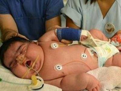 Μωρό γίγας στη Γερμανία με φυσιολογικό τοκετό